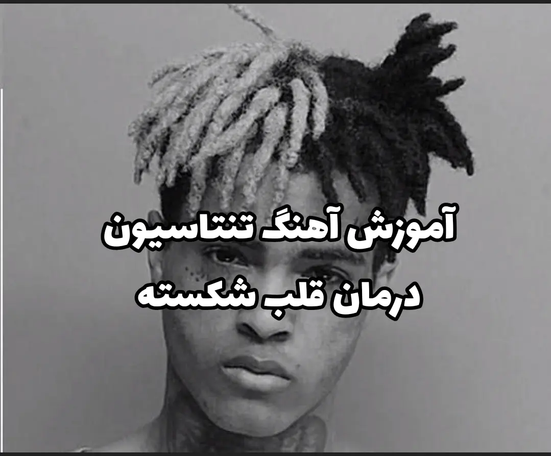 آموزش ملودی آهنگ تنتاسیون the remedy for a broken heart + تبلچر